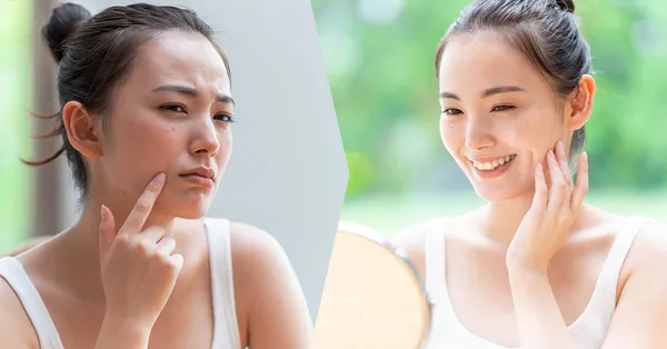 skincare_20_2