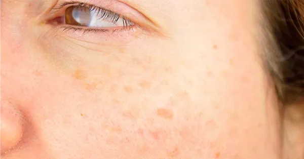 skincare_fifties_24