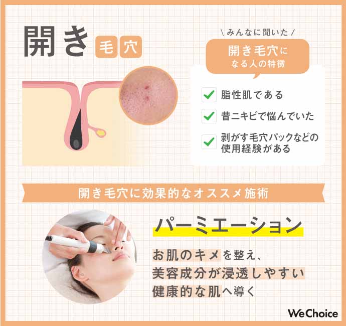 黒ずみ毛穴
