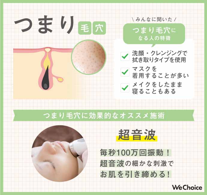 つまり毛穴