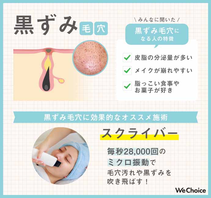 開き毛穴