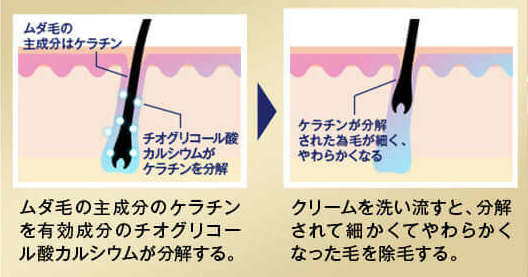 仕組み
