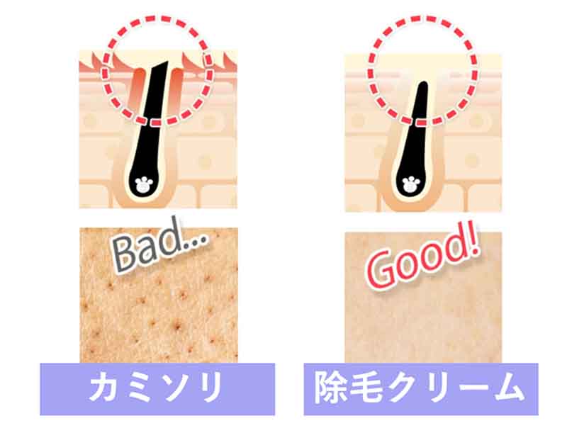 除毛クリーム＿カミソリとの比較